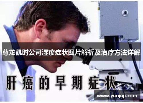 尊龙凯时公司湿疹症状图片解析及治疗方法详解